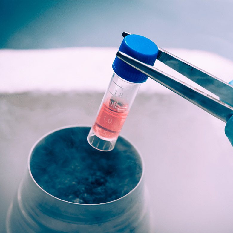 Stem Cell Therapy